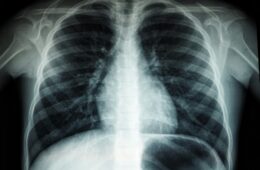 AI, Healthcare and the New Patient Safety Blind Spot