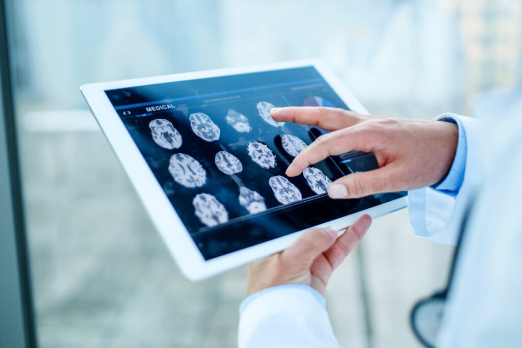 Doctor in white coat reviewing brain MRI scan results on a digital tablet